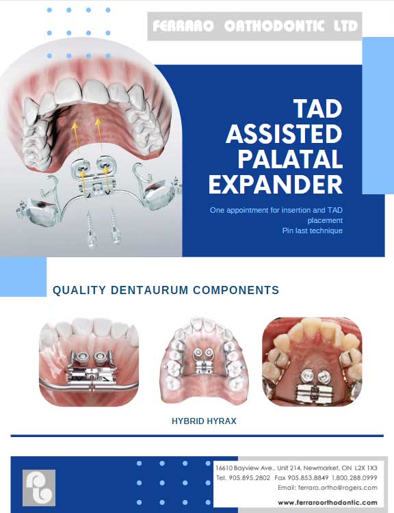 TAD assisted palatal expander